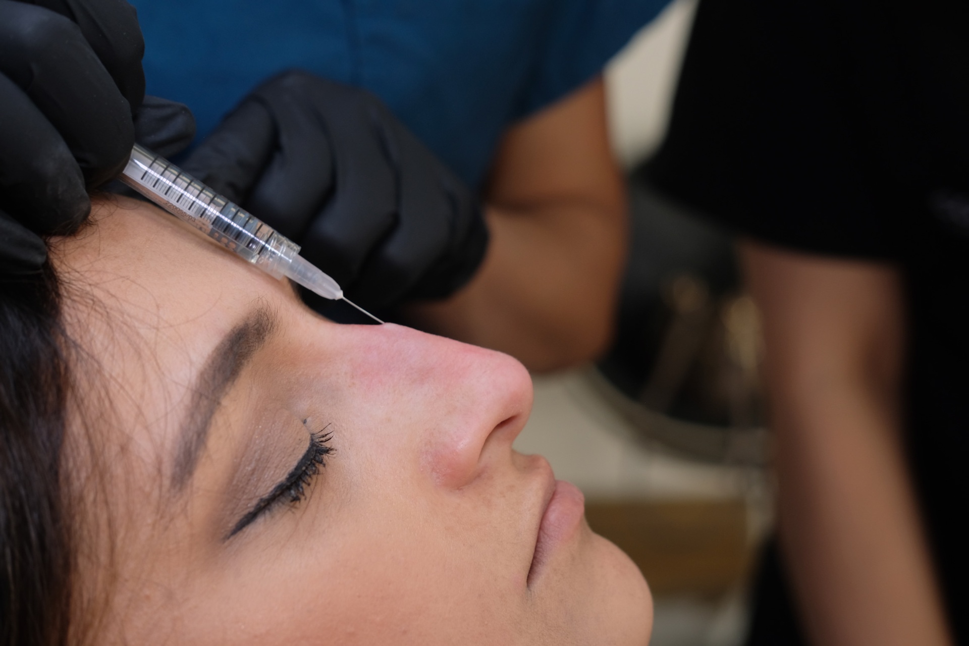 Close-up of a gloved practitioner injecting a fine needle into the glabellar region of a patient's face, illustrating depth-based injection anatomy